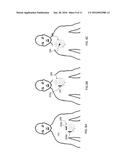 MEDICAL EQUIPMENT ELECTRODES diagram and image