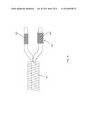 INTERVENTIONAL DRUG DELIVERY SYSTEM AND ASSOCIATED METHODS diagram and image