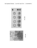 INTERVENTIONAL DRUG DELIVERY SYSTEM AND ASSOCIATED METHODS diagram and image