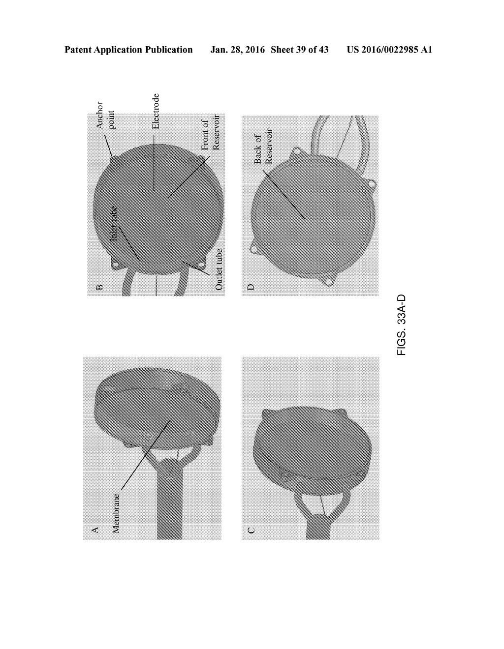 INTERVENTIONAL DRUG DELIVERY SYSTEM AND ASSOCIATED METHODS - diagram, schematic, and image 40