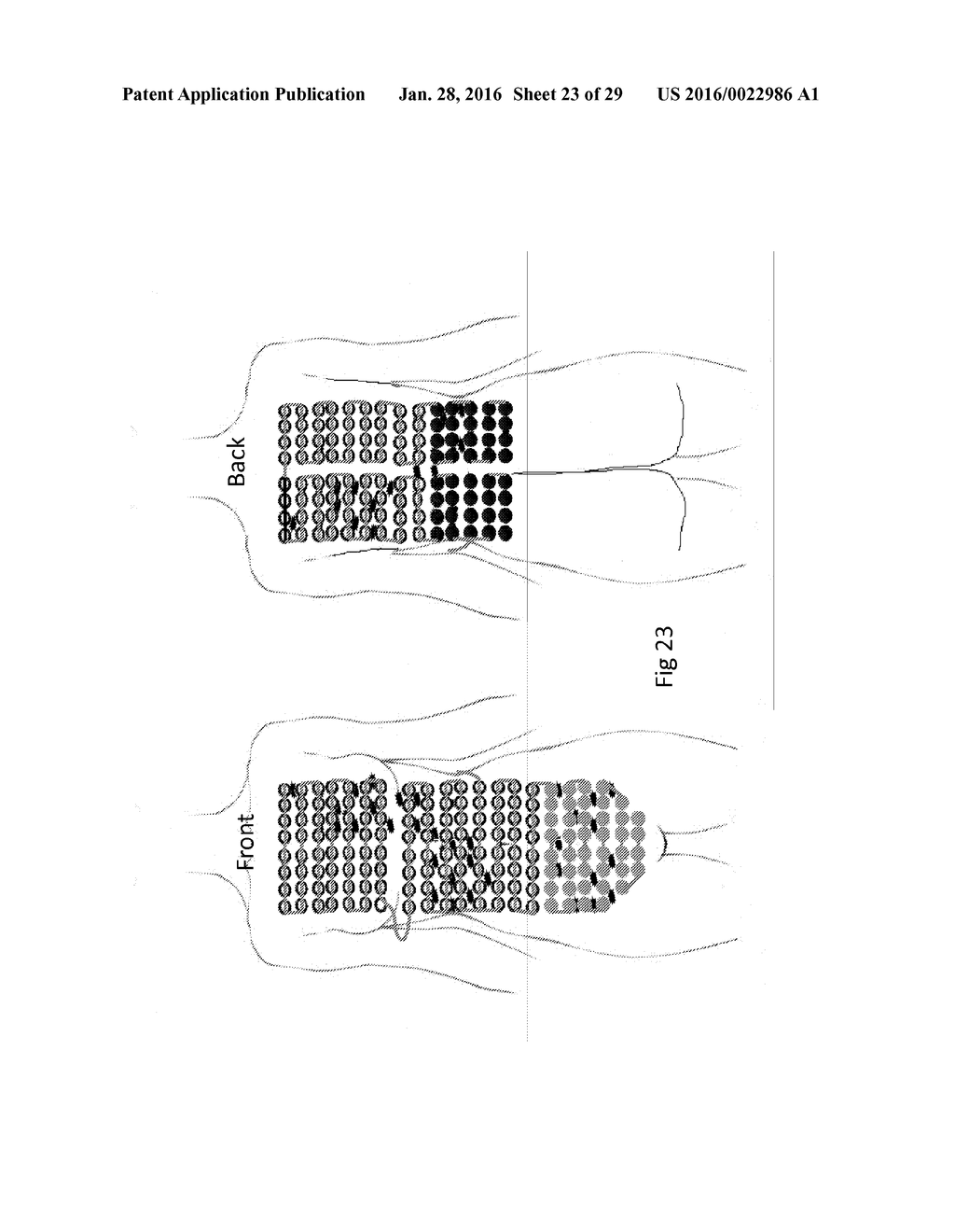 APPARATUS AND METHOD FOR TREATING MULTIPLE TUMORS IN PATIENTS WITH     METASTATIC DISEASE BY ELECTRIC FIELDS - diagram, schematic, and image 24