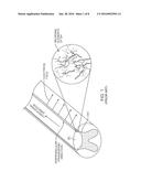 ENHANCED DORSAL HORN STIMULATION USING MULTIPLE ELECTRICAL FIELDS diagram and image