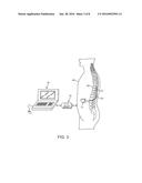 ENHANCED DORSAL HORN STIMULATION USING MULTIPLE ELECTRICAL FIELDS diagram and image