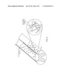 ENHANCED DORSAL HORN STIMULATION USING MULTIPLE ELECTRICAL FIELDS diagram and image