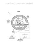 SYSTEM AND METHOD FOR IRRADIATION THERAPY USING VOXEL BASED FUNCTIONAL     MEASUREMENTS OF ORGANS AT RISK diagram and image