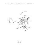 ELECTROSURGICAL ULTRASONIC VESSEL SEALING AND DISSECTING SYSTEM diagram and image