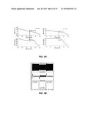 ELECTROSURGICAL ULTRASONIC VESSEL SEALING AND DISSECTING SYSTEM diagram and image