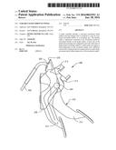 VARIABLE RATIO THROTTLE PEDAL diagram and image