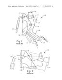 VARIABLE RATIO THROTTLE PEDAL diagram and image