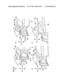 FRONT VEHICLE BODY STRUCTURE diagram and image