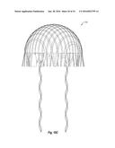 MOVABLE MEMBER BEARING AERIAL VEHICLES AND METHODS OF USE diagram and image