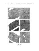 SUBSTITUTED AROMATIC COMPOUNDS FOR THE TREATMENT OF PULMONARY FIBROSIS,     LIVER FIBROSIS,SKIN FIBROSIS AND CARDIAC FIBROSIS diagram and image