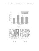 CONNECTIVE TISSUE GROWTH FACTOR ANTIBODIES diagram and image