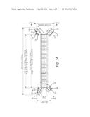 Cantilevered Wing Wall diagram and image