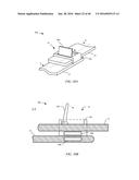 ATTACHMENT APPARATUSES AND ASSOCIATED METHODS OF USE AND MANUFACTURE diagram and image