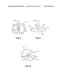 Armor System with Multi-Hit Capacity and Method of Manufacture diagram and image