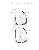 DEVICE FOR RAPID DETACHMENT OF EYEWEAR diagram and image