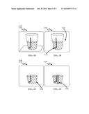 SYSTEM AND METHOD FOR ESTIMATING A QUANTITY OF A BLOOD COMPONENT IN A     FLUID CANISTER diagram and image