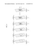 METHOD AND APPARATUS FOR SUPPORTING DIAGNOSIS OF REGION OF INTEREST BY     PROVIDING COMPARISON IMAGE diagram and image