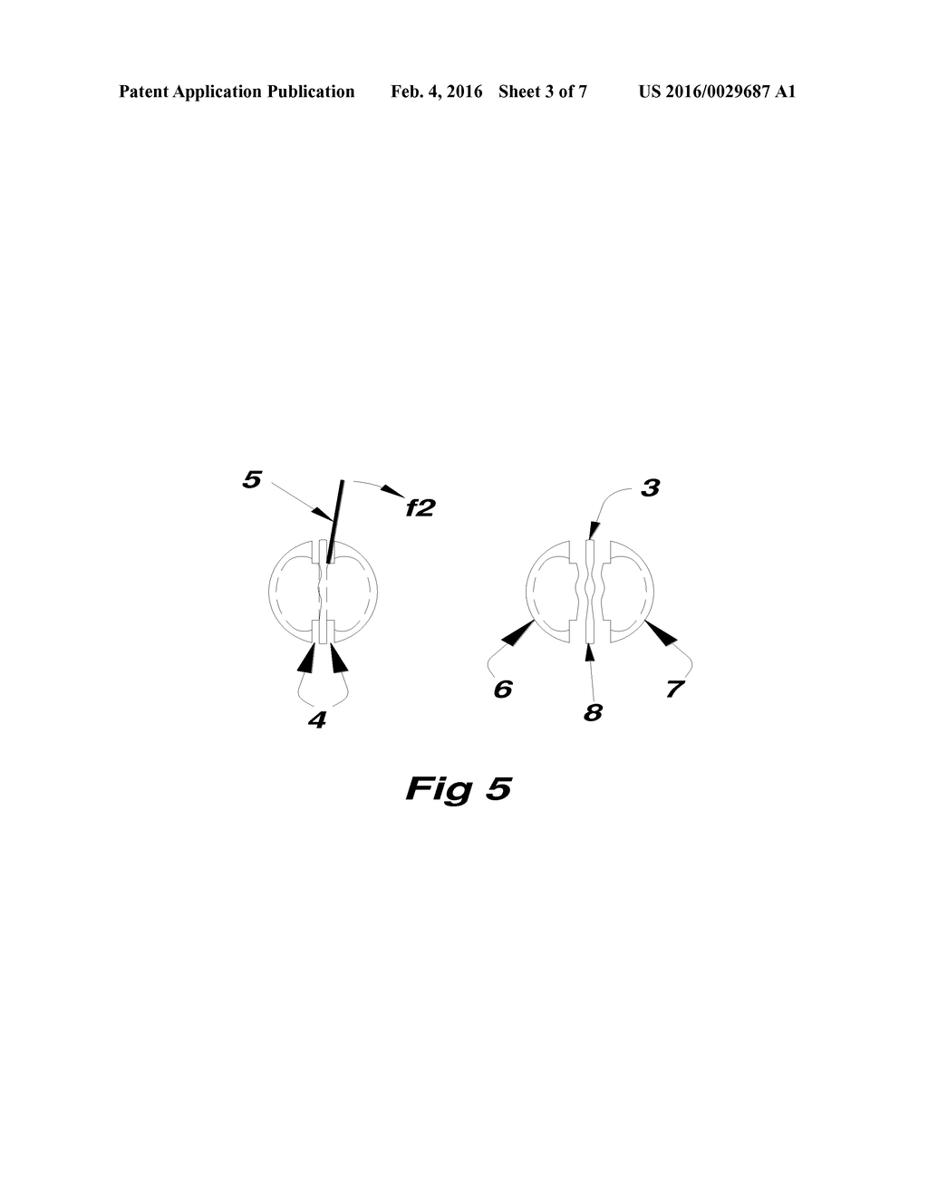 Method and apparatus to yield large kernels from Black Walnuts - diagram, schematic, and image 04