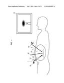 SURGICAL DEVICE, OUTER TUBE, ENDOSCOPE, AND TREATMENT TOOL diagram and image