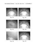 LENS CLEANING INSTRUMENT FOR SURGICAL PROCEDURES PERFORMED IN AN ENCLOSED     CAVITY diagram and image