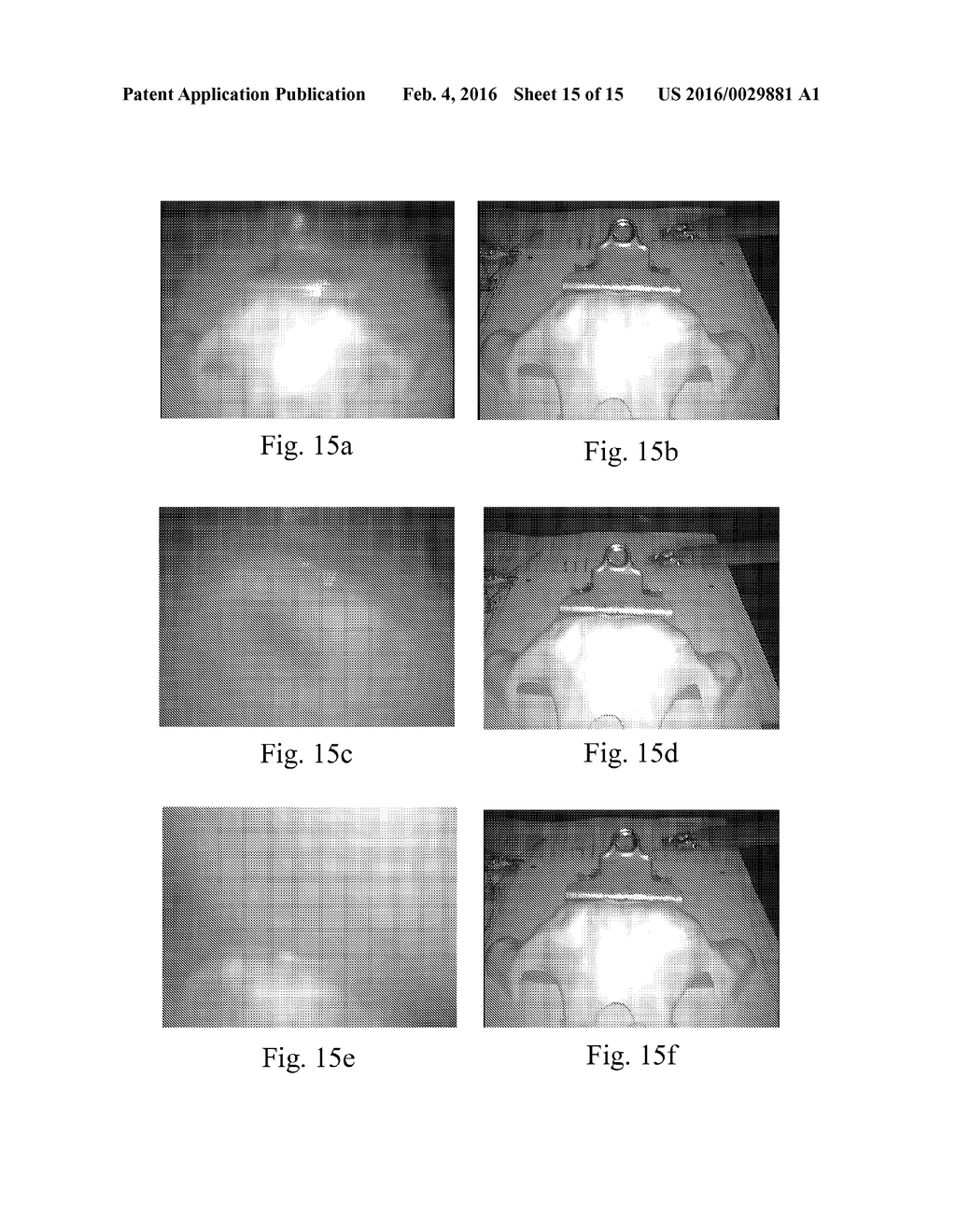 LENS CLEANING INSTRUMENT FOR SURGICAL PROCEDURES PERFORMED IN AN ENCLOSED     CAVITY - diagram, schematic, and image 16