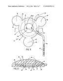 INTRACRANIAL SENSING & MONITORING DEVICE WITH MACRO AND MICRO ELECTRODES diagram and image