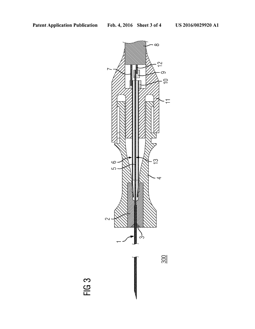 BIOIMPEDANCE SENSOR, STYLET, CANNULA AND METHOD FOR MEASURING BIOIMPEDANCE - diagram, schematic, and image 04