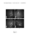 FUNCTIONAL NEAR-INFRARED FLUORESCENCE LYMPHATIC MAPPING FOR DIAGNOSING,     ACCESSING, MONITORING AND DIRECTING THERAPY OF LYMPHATIC DISORDERS diagram and image