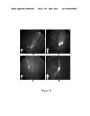 FUNCTIONAL NEAR-INFRARED FLUORESCENCE LYMPHATIC MAPPING FOR DIAGNOSING,     ACCESSING, MONITORING AND DIRECTING THERAPY OF LYMPHATIC DISORDERS diagram and image