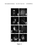 FUNCTIONAL NEAR-INFRARED FLUORESCENCE LYMPHATIC MAPPING FOR DIAGNOSING,     ACCESSING, MONITORING AND DIRECTING THERAPY OF LYMPHATIC DISORDERS diagram and image