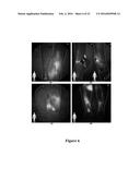 FUNCTIONAL NEAR-INFRARED FLUORESCENCE LYMPHATIC MAPPING FOR DIAGNOSING,     ACCESSING, MONITORING AND DIRECTING THERAPY OF LYMPHATIC DISORDERS diagram and image