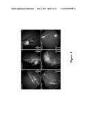 FUNCTIONAL NEAR-INFRARED FLUORESCENCE LYMPHATIC MAPPING FOR DIAGNOSING,     ACCESSING, MONITORING AND DIRECTING THERAPY OF LYMPHATIC DISORDERS diagram and image