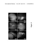 FUNCTIONAL NEAR-INFRARED FLUORESCENCE LYMPHATIC MAPPING FOR DIAGNOSING,     ACCESSING, MONITORING AND DIRECTING THERAPY OF LYMPHATIC DISORDERS diagram and image