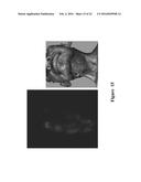 FUNCTIONAL NEAR-INFRARED FLUORESCENCE LYMPHATIC MAPPING FOR DIAGNOSING,     ACCESSING, MONITORING AND DIRECTING THERAPY OF LYMPHATIC DISORDERS diagram and image