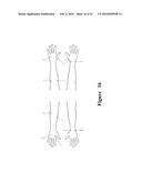 FUNCTIONAL NEAR-INFRARED FLUORESCENCE LYMPHATIC MAPPING FOR DIAGNOSING,     ACCESSING, MONITORING AND DIRECTING THERAPY OF LYMPHATIC DISORDERS diagram and image