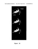 FUNCTIONAL NEAR-INFRARED FLUORESCENCE LYMPHATIC MAPPING FOR DIAGNOSING,     ACCESSING, MONITORING AND DIRECTING THERAPY OF LYMPHATIC DISORDERS diagram and image