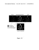 FUNCTIONAL NEAR-INFRARED FLUORESCENCE LYMPHATIC MAPPING FOR DIAGNOSING,     ACCESSING, MONITORING AND DIRECTING THERAPY OF LYMPHATIC DISORDERS diagram and image