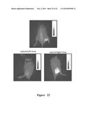 FUNCTIONAL NEAR-INFRARED FLUORESCENCE LYMPHATIC MAPPING FOR DIAGNOSING,     ACCESSING, MONITORING AND DIRECTING THERAPY OF LYMPHATIC DISORDERS diagram and image