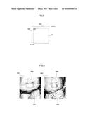 ULTRASONIC DIAGNOSTIC DEVICE AND ULTRASONIC THREE-DIMENSIONAL IMAGE     GENERATION METHOD diagram and image