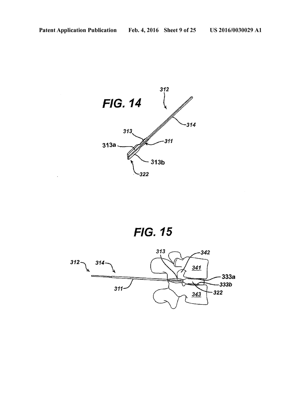 SYSTEMS AND METHODS FOR SPINAL SURGERY - diagram, schematic, and image 10