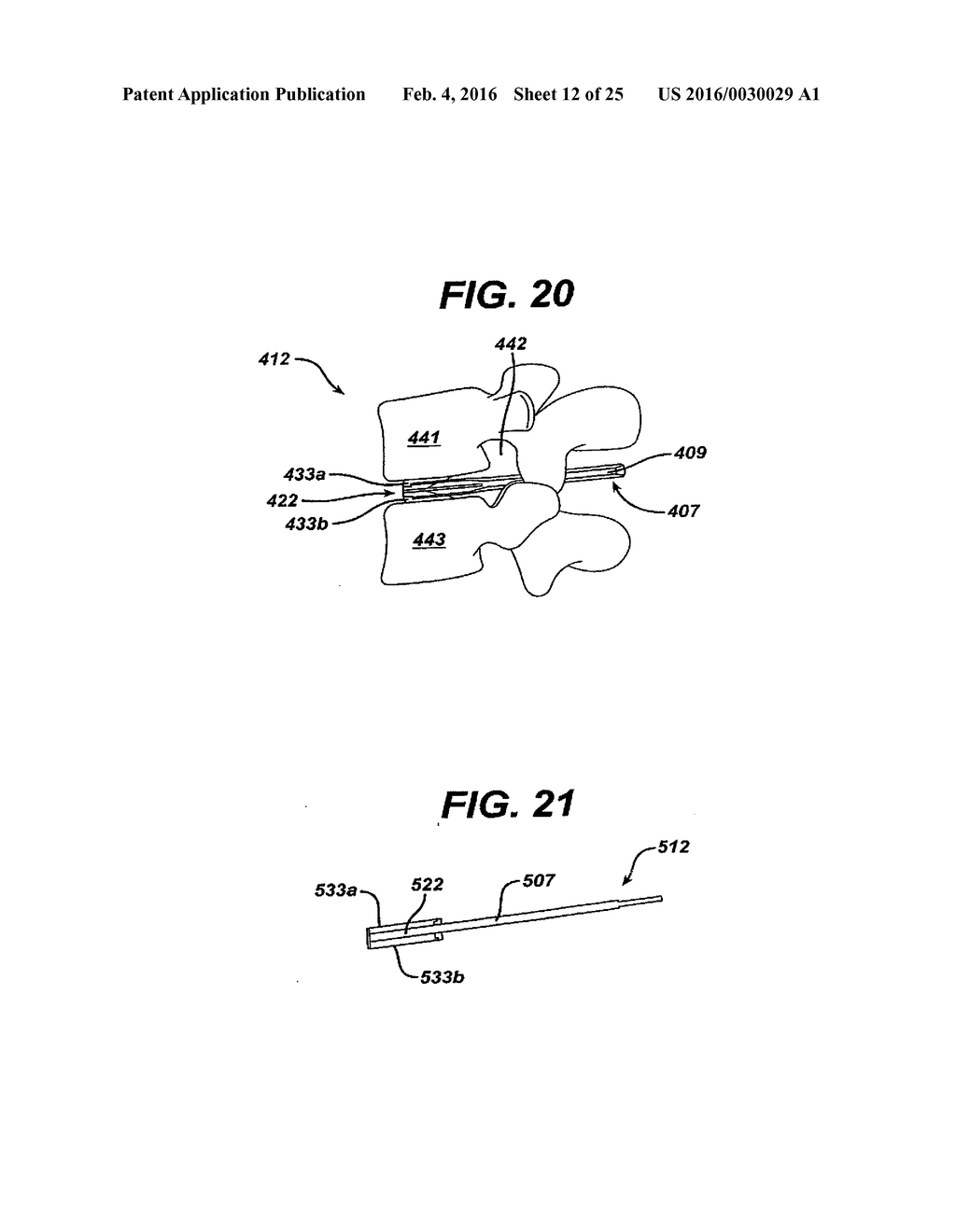 SYSTEMS AND METHODS FOR SPINAL SURGERY - diagram, schematic, and image 13