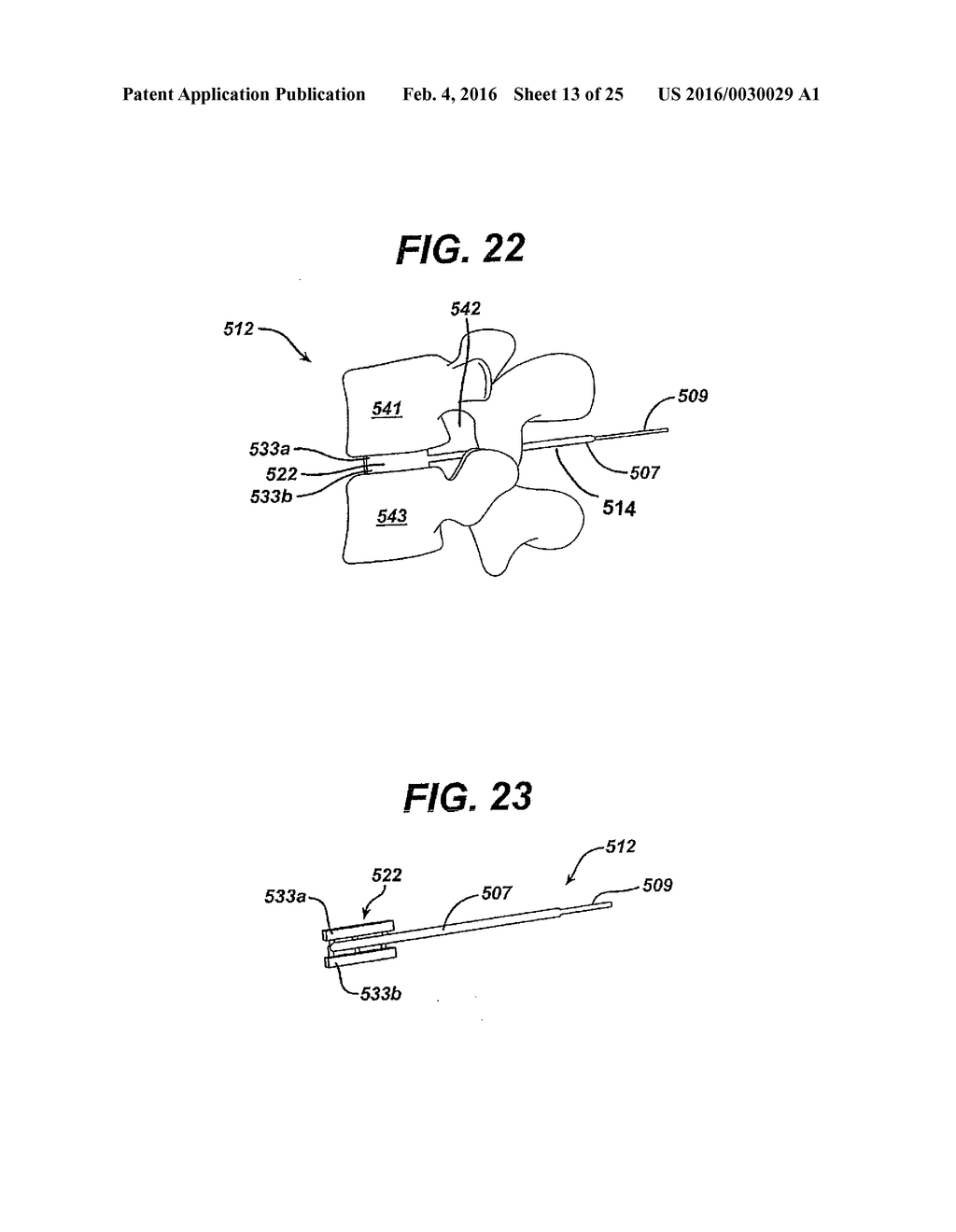 SYSTEMS AND METHODS FOR SPINAL SURGERY - diagram, schematic, and image 14