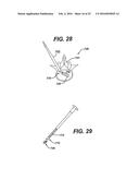 SYSTEMS AND METHODS FOR SPINAL SURGERY diagram and image