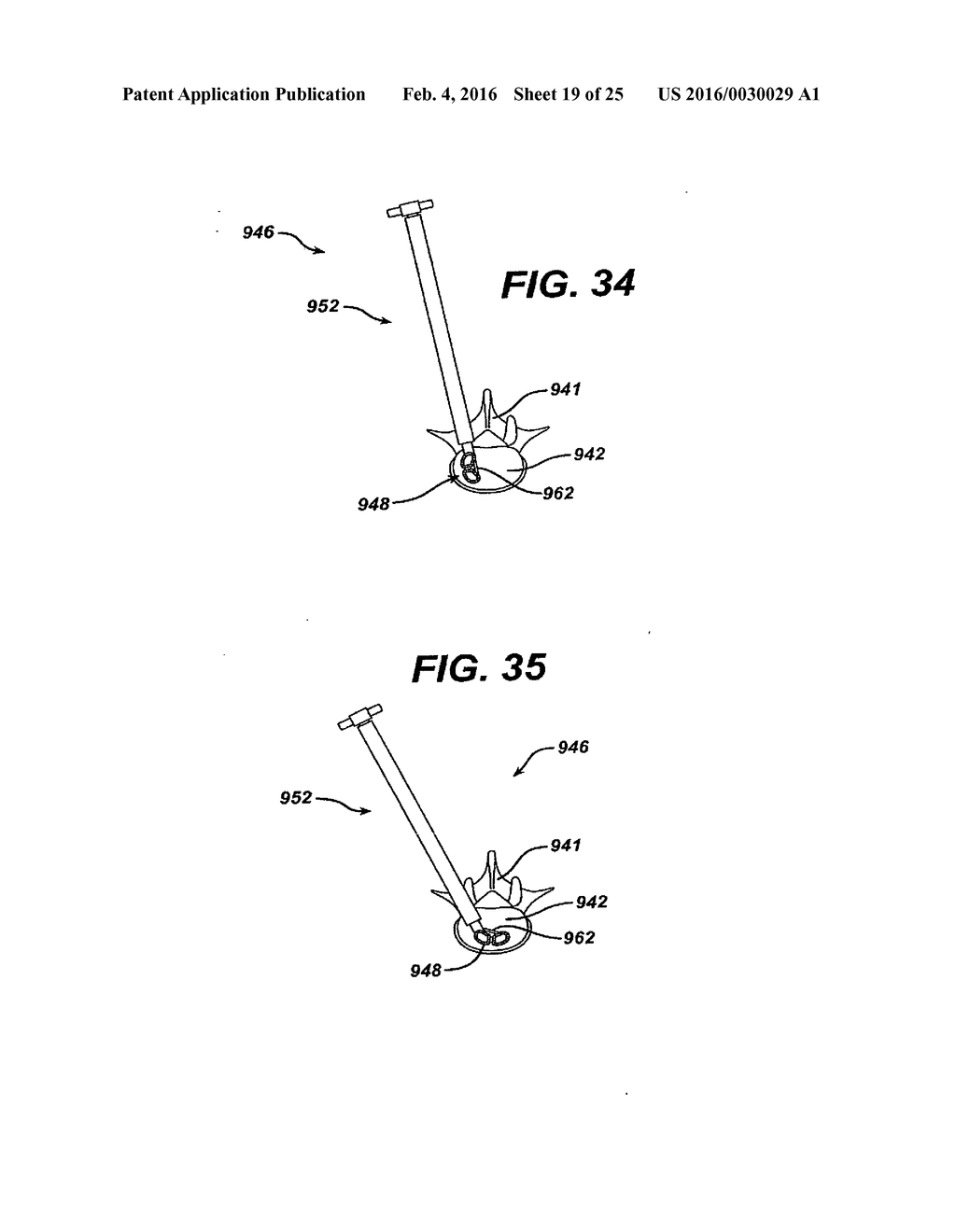 SYSTEMS AND METHODS FOR SPINAL SURGERY - diagram, schematic, and image 20