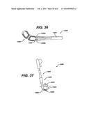 SYSTEMS AND METHODS FOR SPINAL SURGERY diagram and image