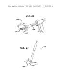 SYSTEMS AND METHODS FOR SPINAL SURGERY diagram and image