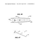 SYSTEMS AND METHODS FOR SPINAL SURGERY diagram and image