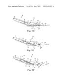 SUTURE ASSEMBLY INCLUDING A SUTURE CLIP diagram and image